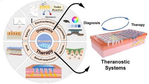 基于微針的生物醫學系統 設計、制造與應用研究進展